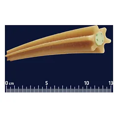ADVANCE „Dental Care Stick Medium/Maxi“ funkcinis skanėstas dantų valymui 180 g — 2 nuotrauka
